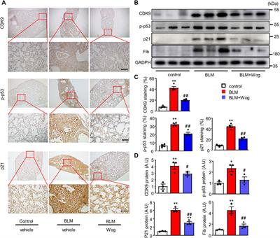 Wogonin protects against bleomycin-induced mouse pulmonary fibrosis via the inhibition of CDK9/p53-mediated cell senescence